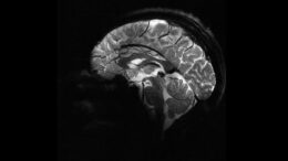 Απίστευτες πρώτες εικόνες εγκεφάλου από τον ισχυρότερο μαγνητικό τομογράφο στον κόσμο