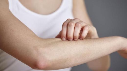 Κνησμός: 10 αιτίες επίμονης φαγούρας στο δέρμα