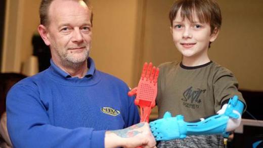 Πατέρας κατασκεύασε μονός του ένα ρομποτικό βραχίονα για τον γιο του που γεννήθηκε χωρίς αριστερό χέρι